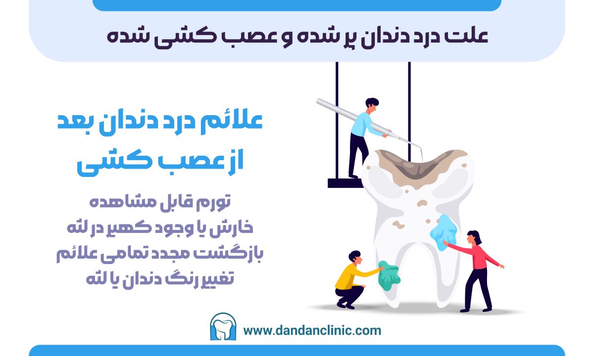 علت درد دندان پر شده و عصب کشی شده